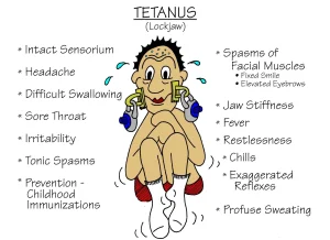 What is Tetanus?